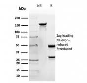 SDS-PAGE analysis of purified, BSA-free Apolipoprotein B antibody (clone APOB/4335) as confirmation of integrity and purity.