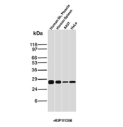 p27Kip1 Antibody Tissue and Cell Line WB. Western blot analysis of p27Kip1 / CDKN1B expression in human tissue and cell lysates using p27Kip1 antibody clone rKIP1/1356. Lane 1: human skeletal muscle lysate, Lane 2: human spleen lysate, Lane 3: A431 cell lysate, Lane 4: HeLa cell lysate. A band is detected at approximately 27-29 kDa, consistent with the predicted molecular weight of p27Kip1 (CDKN1B), a key inhibitor of cyclin-dependent kinases. Detection across normal tissue and cultured cell samples supports the use of this clone for broad western blot validation across diverse sample types.