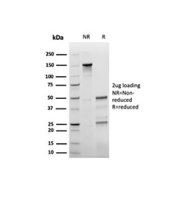 SDS-PAGE analysis of purified, BSA-free recombinant p27Kip1 antibody (clone rKIP1/1356) as confirmation of integrity and purity.