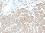 IHC staining of human liver tissue with Leptin Receptor antibody (clone LEPR/4301). HIER: boil tissue sections in pH 9 10mM Tris with 1mM EDTA for 20 min and allow to cool before testing.