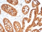 CDH1 Antibody Human Colon IHC. Immunohistochemistry analysis of Cadherin 1 / CDH1 expression in FFPE human colon tissue using clone CDH1/7034R antibody, showing strong membranous HRP-DAB brown staining in epithelial cells lining glandular structures with clear cell-cell junction localization, while surrounding stromal tissue remains largely negative. HIER: boil tissue sections in pH 9 10mM Tris with 1mM EDTA for 20 min and allow to cool before testing. Signal highlights epithelial organization and regulated cell adhesion within colon mucosa.