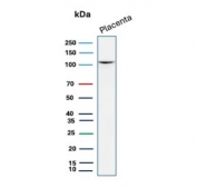 CDH1 Antibody human placental tissue WB. Western blot analysis of Cadherin 1 / CDH1 expression using clone CDH1/7034R antibody, showing a band near the predicted molecular weight of E-cadherin. E-cadherin is synthesized as a precursor and undergoes glycosylation, resulting in an apparent molecular weight typically observed between approximately 80-120 kDa, with the precursor form near 135 kDa. The detected band is consistent with mature glycosylated CDH1 expressed in placental epithelial tissue.