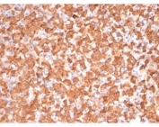 PRKCI Antibody / Atypical Protein Kinase C Antibody Dog Liver IHC. Immunohistochemical staining of FFPE dog liver tissue using PRKCI Antibody / Atypical Protein Kinase C Antibody, clone PRKCI/4911. PRKCI expression is observed as strong cytoplasmic staining within hepatocytes, consistent with the protein's role as an atypical serine/threonine kinase involved in cell polarity and intracellular signaling. Heat-induced epitope retrieval was performed using pH 9 Tris-EDTA buffer for 20 minutes prior to immunostaining.