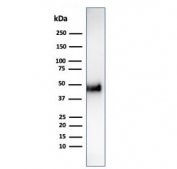 Western blot testing of human HCT-116 cell lysate using CCNE1 antibody (clone CCNE1/4935R). Predicted molecular weight ~47 kDa.