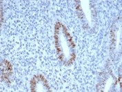CCNE1 Antibody Endometrium IHC. Immunohistochemistry staining of FFPE human endometrium with CCNE1 antibody (clone CCNE1/4935R). HIER: boil tissue sections in pH 9 10mM Tris with 1mM EDTA for 20 min and allow to cool before testing.