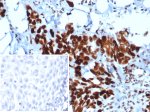 Recombinant MSH6 Antibody MSH6/6654R in Human Esophagus IHC. Immunohistochemistry testing of Recombinant MSH6 Antibody, clone MSH6/6654R, in FFPE human esophagus tissue. Strong nuclear staining is observed in epithelial cells, consistent with the nuclear localization of MSH6. The inset shows a secondary-only negative control in which PBS was substituted for the primary antibody, demonstrating minimal background staining under the tested conditions.
