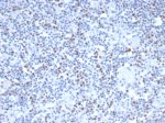Recombinant MSH6 Antibody MSH6/6654R in Dog Lymph Node IHC. Immunohistochemistry testing of Recombinant MSH6 Antibody, clone MSH6/6654R, in FFPE dog lymph node tissue. Heat-induced epitope retrieval was performed in Tris/EDTA buffer, pH 9.0, for 45 min. An HRP-polymer secondary detection system was applied for 30 min followed by DAB for 5 min. Nuclear staining is observed in a subset of lymphoid cells, consistent with the nuclear localization of MSH6.