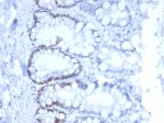 Recombinant MSH6 Antibody MSH6/6654R in Cat Colon IHC. Immunohistochemistry testing of Recombinant MSH6 Antibody, clone MSH6/6654R, in FFPE cat colon tissue. Heat-induced epitope retrieval was performed in Tris/EDTA buffer, pH 9.0, for 45 min. An HRP-polymer secondary detection system was applied for 30 min followed by DAB for 5 min. Nuclear staining is observed in colonic epithelial cells, consistent with the nuclear localization of MSH6.