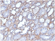 Immunohistochemistry of Collagen IV antibody in human kidney tissue. Formalin-fixed, paraffin-embedded human kidney was stained using Collagen IV antibody clone M3F7. Heat induced epitope retrieval was performed by boiling tissue sections in 10mM Tris with 1mM EDTA, pH 9, for 20 min followed by cooling prior to staining. HRP-DAB brown chromogenic signal outlines glomerular and tubular basement membranes, demonstrating the characteristic linear extracellular staining pattern of Collagen type IV within renal tissue.