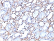 IHC staining of FFPE human kidney tissue with Collagen IV antibody clone M3F7. HIER: boil tissue sections in pH 9 10mM Tris with 1mM EDTA for 20 min and allow to cool before testing.
