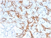 IHC staining of FFPE human kidney adenocarcinoma tissue with Collagen IV antibody clone M3F7 at 2ug/ml in PBS for 30min RT. Strong staining of glomeruli is observed. Negative control inset: PBS instead of primary antibody to control for secondary binding. HIER: boil tissue sections in pH 9 10mM Tris with 1mM EDTA for 20 min and allow to cool before testing.