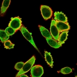 EIF2S1 Antibody HeLa IF. Immunofluorescence analysis of PFA-fixed human HeLa cells stained with EIF2S1 antibody detecting eIF2 alpha (green), clone PCRP-EIF2S1-1E2. Diffuse cytoplasmic staining with perinuclear enrichment is observed, consistent with EIF2S1 localization in ribosome-associated translation initiation complexes and involvement in cellular protein synthesis. Phalloidin counterstain (red) highlights the actin cytoskeleton.