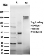 SDS-PAGE analysis of purified, BSA-free EIF2S1 antibody (PCRP-EIF2S1-1E2) as confirmation of integrity and purity.