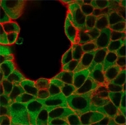 IRF3 Antibody MCF-7 Immunofluorescence. Immunofluorescent analysis of human MCF-7 cells stained with IRF3 Antibody demonstrates predominantly cytoplasmic and perinuclear green fluorescence consistent with IRF3-associated innate immune signaling and interferon regulatory pathway localization. This innate immune signaling antibody highlights antiviral response-associated transcriptional regulatory biology and stress-response signaling organization in epithelial-derived tumor cells. Phalloidin co-staining (red) labels actin-associated cytoskeletal structures.
