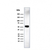 IRF3 Antibody MCF7 WB. Western blot analysis of human MCF7 cell lysate using IRF3 Antibody detects a strong band at approximately 47-50 kDa, consistent with the predicted molecular weight of Interferon regulatory factor 3 / IRF3. This innate immune signaling antibody highlights IRF3-associated antiviral response pathways and interferon-regulatory transcriptional signaling in epithelial-derived breast cancer cells.