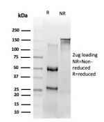SDS-PAGE analysis of purified, BSA-free RELA antibody (PCRP-RELA-2B6) as confirmation of integrity and purity.