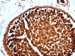 SCGB2A2 Antibody for IHC clone MGB/4812R immunohistochemistry of human lactating breast tissue. FFPE human lactating breast tissue was stained with SCGB2A2 Antibody for IHC. HRP-DAB brown chromogenic signal highlights strong cytoplasmic staining in secretory epithelial cells lining mammary glandular structures, consistent with the high expression of Mammaglobin A / SCGB2A2 in lactating breast epithelium, while surrounding stromal cells show minimal staining. Heat-induced epitope retrieval was performed by boiling tissue sections in pH 9 10mM Tris with 1mM EDTA for 20 minutes followed by cooling prior to staining.