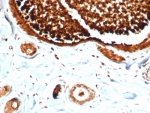 SCGB2A2 Antibody for IHC clone MGB/4812R immunohistochemistry of human lactating breast tissue. FFPE human lactating breast tissue was stained with SCGB2A2 Antibody for IHC. HRP-DAB brown chromogenic signal highlights strong cytoplasmic staining in secretory epithelial cells within mammary glandular structures, consistent with elevated Mammaglobin A / SCGB2A2 expression in lactating breast epithelium, while surrounding stromal cells and connective tissue elements show minimal staining. Heat-induced epitope retrieval was performed by boiling tissue sections in pH 9 10mM Tris with 1mM EDTA for 20 minutes followed by cooling prior to staining.