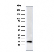 Recombinant FABP5 Antibody HeLa WB. Western blot testing of human HeLa cell lysate using recombinant FABP5 antibody (clone rFABP5/6354). Predicted molecular weight ~15 kDa.