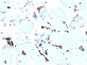 Recombinant FABP5 Antibody Esophagus Immunohistochemistry. IHC staining of FFPE human esophagus tissue with recombinant FABP5 antibody (clone rFABP5/6354). HIER: boil tissue sections in pH 9 10mM Tris with 1mM EDTA for 20 min and allow to cool before testing.