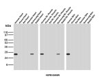 Recombinant HSP27 Antibody HSPB1/6490R Detection Across Multiple Species WB. Western blot analysis of heart, skeletal muscle and skin tissue lysates from human, mouse, rat, guinea pig, hamster and rabbit using Recombinant HSP27 Antibody clone HSPB1/6490R. Strong bands at approximately 27-28 kDa are detected in human heart, skeletal muscle and skin, with weaker bands in guinea pig heart and hamster skeletal muscle. Little to no corresponding signal is observed in the remaining samples, demonstrating species-dependent recognition of HSPB1/HSP27 by this recombinant rabbit monoclonal antibody.