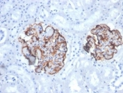 Vimentin Antibody / Wound Healing Marker Antibody Dog Kidney IHC. Immunohistochemistry analysis of FFPE dog kidney tissue using Vimentin antibody shows strong HRP-DAB brown cytoplasmic staining in tubular epithelial-associated stromal cells and interstitial cell populations. The rabbit monoclonal clone VIM/6430R highlights filamentous cytoplasmic staining within supporting cells of the renal interstitium, with minimal staining in surrounding epithelial compartments. The distribution of Vimentin-positive cells is consistent with stromal activation and tissue-supporting cell populations associated with repair and remodeling processes in kidney tissue.