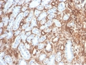 Vimentin Antibody / Wound Healing Marker Antibody Cat Kidney IHC. Immunohistochemistry analysis of FFPE cat kidney tissue using Vimentin antibody shows strong HRP-DAB brown cytoplasmic staining in interstitial and stromal cell populations surrounding renal tubules, with minimal staining in most tubular epithelial cells. The rabbit monoclonal clone VIM/6430R highlights filamentous cytoplasmic staining within supporting cells of the renal interstitium. The distribution of Vimentin-positive cells is consistent with stromal and fibroblast-like populations associated with tissue support, repair, and remodeling processes in kidney tissue.