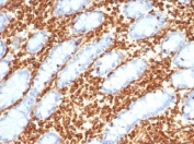 Vimentin Antibody Horse Small Intestine IHC. Immunohistochemistry staining of FFPE horse small intestine tissue with recombinant Vimentin antibody (clone VIM/6430R). HIER: boil tissue sections in pH 9 10mM Tris with 1mM EDTA for 20 min and allow to cool before testing.
