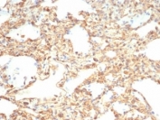 Vimentin Antibody / Wound Healing Marker Antibody Horse Lung IHC. Immunohistochemistry analysis of FFPE horse lung tissue using Vimentin antibody shows strong HRP-DAB brown cytoplasmic staining in interstitial stromal cells within alveolar septa, with minimal staining in most alveolar epithelial cells. The rabbit monoclonal clone VIM/6430R highlights filamentous cytoplasmic staining in fibroblast-like cells distributed throughout the lung parenchyma. The distribution of Vimentin-positive cells is consistent with stromal cell populations involved in tissue support and repair processes within pulmonary tissue.