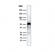 Vimentin Antibody / Wound Healing Marker Antibody WB. Western blot analysis of human U-87 MG cell lysate using Vimentin antibody detects a band at approximately 55 kDa, consistent with the predicted molecular weight of Vimentin (VIM). The band supports detection of cytoskeletal components associated with activated stromal and repair-associated cell states. The presence of Vimentin in U-87 MG cells is consistent with its role in cytoskeletal organization linked to tissue remodeling and wound healing-associated cellular activity.