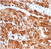 Immunohistochemistry analysis of Smooth Muscle Actin / ACTA2 antibody (clone rACTA2/1625) in human uterus tissue. FFPE human uterus demonstrates strong cytoplasmic HRP-DAB brown staining in smooth muscle cells of the myometrium, consistent with Alpha smooth muscle actin expression. Staining is diffuse and intense within elongated spindle-shaped smooth muscle cells arranged in interlacing bundles, while surrounding stromal elements show comparatively weaker signal. Nuclei are counterstained blue. Heat induced epitope retrieval was performed by boiling tissue sections in 10 mM Tris with 1 mM EDTA, pH 9.0, for 20 minutes followed by cooling prior to immunostaining.
