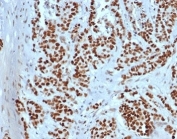 MSH2 Antibody Recombinant Mouse MAb rMSH2/6548. Immunohistochemistry of FFPE human colon tissue demonstrates strong nuclear staining in epithelial cells, consistent with the nuclear localization of MutS homolog 2 (MSH2), a key DNA mismatch repair protein. Brown chromogenic signal highlights MSH2-positive nuclei throughout the colonic epithelium, while surrounding stromal cells show weaker or variable staining. Heat-induced epitope retrieval was performed by boiling tissue sections in pH 9 10mM Tris with 1mM EDTA for 20 minutes followed by cooling prior to antibody incubation.