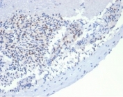 MSH2 Antibody Recombinant Mouse MAb rMSH2/6548. Immunohistochemistry of FFPE dog lymph node tissue demonstrates nuclear staining in lymphoid cells, consistent with the nuclear localization of MutS homolog 2 (MSH2), a DNA mismatch repair protein involved in maintaining genomic stability. Brown chromogenic signal highlights MSH2-positive nuclei among lymphocyte populations within the lymph node architecture, while surrounding stromal elements show weaker or minimal staining. Heat-induced epitope retrieval was performed by boiling tissue sections in pH 9 10mM Tris with 1mM EDTA for 20 minutes followed by cooling prior to antibody incubation.