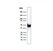 VIM Antibody / Cytoskeletal Stability Marker Antibody WB. Western blot analysis of human U-87 MG cell lysate using Vimentin antibody detects a prominent band at approximately 55 kDa, consistent with the predicted molecular weight of Vimentin (VIM). The recombinant rabbit monoclonal clone rVIM/6431 shows a clear, well-defined band, supporting detection of stable intermediate filament structures. The consistent band intensity reflects Vimentin expression associated with maintained cytoskeletal integrity and structural stability in mesenchymal-like tumor cells.