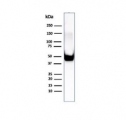 Vimentin Antibody / Cytoskeletal Remodeling Marker Antibody WB. Western blot analysis of human U-87 MG cell lysate using Vimentin antibody detects a strong band at approximately 55 kDa, consistent with the predicted molecular weight of Vimentin (VIM). The rabbit monoclonal clone rVIM/6575 shows a prominent band, supporting detection of intermediate filament components involved in dynamic cytoskeletal reorganization. The banding pattern aligns with Vimentin expression in cells exhibiting active structural adaptation and reinforces its use as a cytoskeletal remodeling marker in mesenchymal and tumor-derived cell systems.