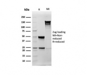 SDS-PAGE analysis of purified, BSA-free Vimentin antibody (clone rVIM/6575) as confirmation of integrity and purity.
