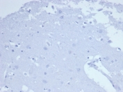 CD7 Antibody Negative Control. Immunohistochemistry analysis of CD7 / T-cell antigen CD7 in human brain tissue shows no HRP-DAB brown staining with only hematoxylin counterstain visible, consistent with the absence of CD7-positive lymphoid cells in non-lymphoid tissue and supporting specificity for thymocyte and T cell populations. Recombinant CD7 antibody clone CD7/6388R was applied at 2 ug/ml following heat-induced epitope retrieval in pH 9 Tris-EDTA buffer, serving as a negative tissue control in FFPE sections.
