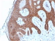 Cadherin 1 Antibody Skin IHC. Immunohistochemistry analysis of Cadherin 1 / CDH1 expression in FFPE human skin using clone CDH1/4585 antibody, showing strong membranous HRP-DAB brown staining in stratified epithelial cells of the epidermis with clear cell-cell junction localization, while underlying dermal tissue remains largely negative. HIER: boil tissue sections in pH 9 10mM Tris with 1mM EDTA for 20 min and allow to cool before testing. Signal highlights epithelial organization and adhesion-associated signaling within the epidermis.