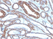 Cadherin 1 Antibody Human Kidney IHC. Immunohistochemistry analysis of Cadherin 1 / CDH1 expression in FFPE human kidney tissue using clone CDH1/4585 antibody, showing membranous HRP-DAB brown staining in epithelial cells lining renal tubules with clear cell-cell junction localization, while surrounding interstitial tissue remains largely negative. HIER: boil tissue sections in pH 9 10mM Tris with 1mM EDTA for 20 min and allow to cool before testing. Signal highlights epithelial organization and adhesion-associated signaling within renal tubular structures.