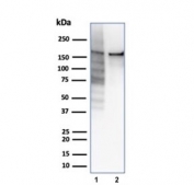 TOP2A Antibody / DNA Topoisomerase II Alpha Antibody (clone rTOP2A/6569). Western blot analysis of human cell lysates demonstrates detection of DNA Topoisomerase II alpha protein following SDS-PAGE separation and membrane transfer. Lane 1: HeLa cell lysate. Lane 2: Jurkat cell lysate. A band is detected at approximately 170-180 kDa, consistent with the predicted molecular weight of DNA Topoisomerase II alpha / TOP2A (~174 kDa). The clear band observed in both lysates confirms recognition of denatured DNA Topoisomerase II alpha protein in western blot assays and supports the use of this antibody for western blot detection of the DNA Topoisomerase II alpha enzyme in human cell lysates.