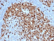 Topoisomerase II alpha Antibody / Mitotic Chromosome Enzyme Antibody (clone TOP2A/6570R). Immunohistochemistry analysis of FFPE human tonsil tissue demonstrates strong nuclear staining of DNA Topoisomerase II alpha in proliferating lymphoid cells. Nuclear immunoreactivity is most prominent within germinal center lymphocytes, reflecting the elevated mitotic activity of these cells where mitotic chromosome condensation and organization are actively occurring. As a Mitotic Chromosome Enzyme Antibody, clone TOP2A/6570R highlights cells undergoing mitosis in which DNA Topoisomerase II alpha supports mitotic chromosome architecture and chromosome condensation required for accurate cell division. HIER: boil tissue sections in pH 9 Tris-EDTA buffer for 20 min followed by cooling at RT prior to immunohistochemistry staining.