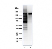 Topoisomerase II alpha Antibody / Mitotic Chromosome Enzyme Antibody (clone TOP2A/6570R). Western blot analysis of human cell lysates demonstrates detection of DNA Topoisomerase II alpha following SDS-PAGE separation and membrane transfer. Lane 1: HeLa cell lysate. Lane 2: Jurkat cell lysate. A band is detected at approximately 170-180 kDa, consistent with the predicted molecular weight of DNA Topoisomerase II alpha / TOP2A (~174 kDa). The detected protein corresponds to the mitotic chromosome enzyme responsible for regulating DNA topology during chromosome condensation and mitotic chromosome organization. Detection of the denatured TOP2A protein band supports the use of this Mitotic Chromosome Enzyme Antibody for western blot analysis of this mitotic chromosome regulatory enzyme in human cell lysates.