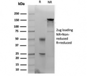 SDS-PAGE analysis of purified, BSA-free CK14 antibody (clone KRT14/4133) as confirmation of integrity and purity.
