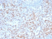 CD5 Antibody. Immunohistochemistry analysis of CD5 antibody staining in FFPE human tonsil tissue using a T cell activation regulator antibody, clone rC5/6462. Strong membranous staining is observed in interfollicular T lymphocytes with widespread distribution across T cell zones, while germinal center B cell regions remain largely negative. The staining pattern reflects the role of CD5 in modulating T cell activation within lymphoid tissue and supports clear identification of T cell-rich compartments. Heat-induced epitope retrieval was performed using pH 9 Tris-EDTA buffer for 20 minutes followed by cooling prior to antibody incubation.