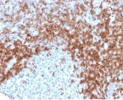CD5 Antibody. Immunohistochemistry analysis of CD5 antibody staining in FFPE human tonsil tissue using an immune tolerance regulator antibody, clone rC5/6429. Strong membranous staining is observed in interfollicular T lymphocytes with dense labeling of T cell zones surrounding germinal centers, while follicular B cell regions remain largely negative. The staining pattern highlights normal tonsillar architecture and reflects the role of CD5 in maintaining immune tolerance within lymphoid tissue. Heat-induced epitope retrieval was performed using pH 9 Tris-EDTA buffer for 20 minutes followed by cooling prior to antibody incubation.