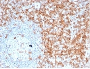 CD5 Antibody. Immunohistochemistry analysis of CD5 antibody staining in FFPE human tonsil tissue using a lymphocyte signaling modulator antibody, clone C5/6463R. Strong membranous staining is observed in interfollicular T lymphocytes with dense labeling of T cell zones surrounding germinal centers, while follicular B cell areas remain largely negative. The staining pattern highlights normal tonsillar architecture and reflects the role of CD5 in modulating lymphocyte signaling within immune compartments. Heat-induced epitope retrieval was performed using pH 9 Tris-EDTA buffer for 20 minutes followed by cooling prior to antibody incubation.