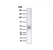 CD5 Antibody for WB. Western blot analysis of CD5 antibody in human Jurkat cell lysate using a T cell development marker antibody, clone C5/6438R. A band is detected at approximately 55-67 kDa, consistent with the predicted molecular weight of CD5, with size variation reflecting known glycosylation of this membrane glycoprotein. The strong signal observed in this T cell-derived lysate aligns with the established role of CD5 in thymocyte maturation and T cell development.