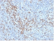 CD5 Antibody for IHC. Immunohistochemistry analysis of CD5 antibody staining in FFPE human tonsil tissue using a T cell development marker antibody, clone C5/6438R. Membranous staining is observed in T lymphocytes within interfollicular regions, with labeling concentrated in T cell zones surrounding germinal centers while follicular B cell areas remain largely negative. The staining pattern reflects expected localization of CD5 in lymphocyte populations and supports its role in T cell development and maturation within lymphoid tissue. Heat-induced epitope retrieval was performed using pH 9 Tris-EDTA buffer for 20 minutes followed by cooling prior to antibody incubation.
