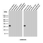 GZMB Antibody in Multi-Species Spleen and Lung WB. Western blot testing of GZMB Antibody / Granzyme B in spleen and lung tissue lysates from human, mouse, rat, hamster, guinea pig and rabbit. A strong, discrete band is observed at approximately 31-32 kDa in human spleen and human lung, while no corresponding band is detected in the tested mouse, rat, hamster, guinea pig or rabbit tissues. This GZMB Antibody demonstrates detection of endogenous Granzyme B in the tested human tissues.