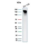 Western blot testing of human DU 145 cell lysate using recombinant MSH6 antibody (clone MSH6/4592R). Expected molecular weight: 120-160 kDa depending on phosphorylation level.